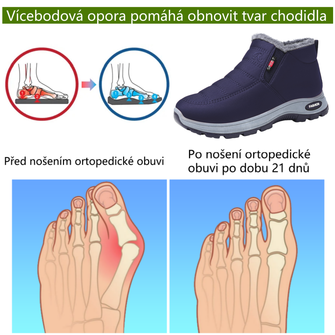 ⚡Omezený sleva 50 % - Ergonomické ortopedické boty - Pro úlevu od bolesti nohou, zad a kloubů - Unisex