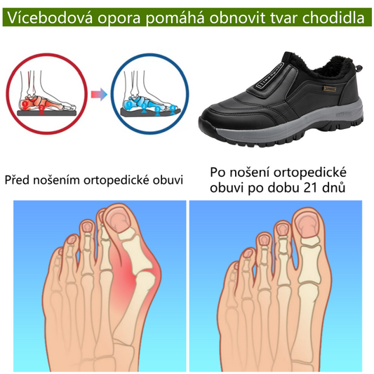 ⚡Omezený slevy 50% —— Ergonomická ortopedická obuv s chloupkatou podšívkou, ulevuje od bolestí nohou, zad a kloubů, unisex