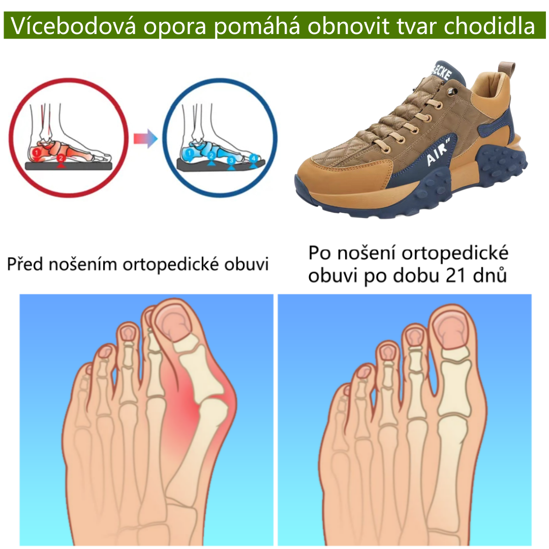 🔥 50% sleva | ortopedická obuv Wrapmio® | Poskytuje oporu klenby, zmírňuje bolest a usnadňuje chůzi | Vhodná pro muže i ženy.