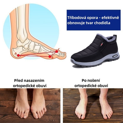🎉 Dnešní speciální nabídka: sleva 50 % – nenechte si ji ujít! ⏰ Ergonomická ortopedická zimní obuv, která účinně ulevuje od bolesti nohou, kolen a zad ✅ vhodná pro muže i ženy.