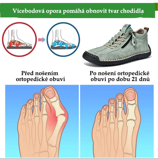 (🔥 Sleva 50 % – Nenechte si to ujít!) Kožené boty „Zero Fatigue“: Boční zip, podpora klenby a protiskluzová podrážka – Ergonomický design zmírňuje únavu.